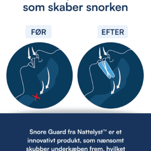 Snore Guard (Bideskinne mod Snorken)