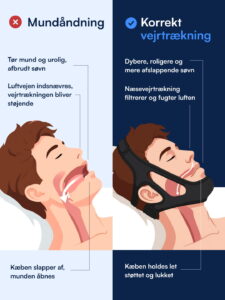 Hagestrop (Mod snorken)